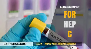 Hep C Testing: A Standard Procedure for Blood Banks?