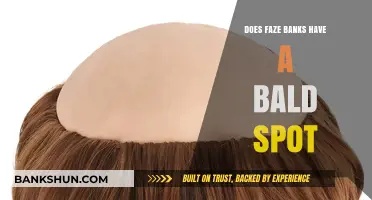 Does FaZe Banks Have a Bald Spot? The Truth Revealed