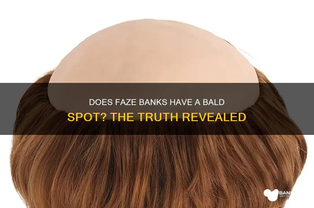 does faze banks have a bald spot