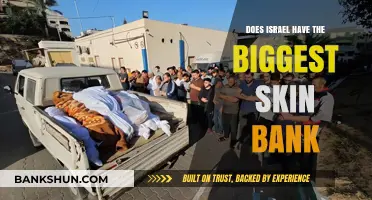 Israel's Skin Bank: The World's Largest? Uncovering the Truth
