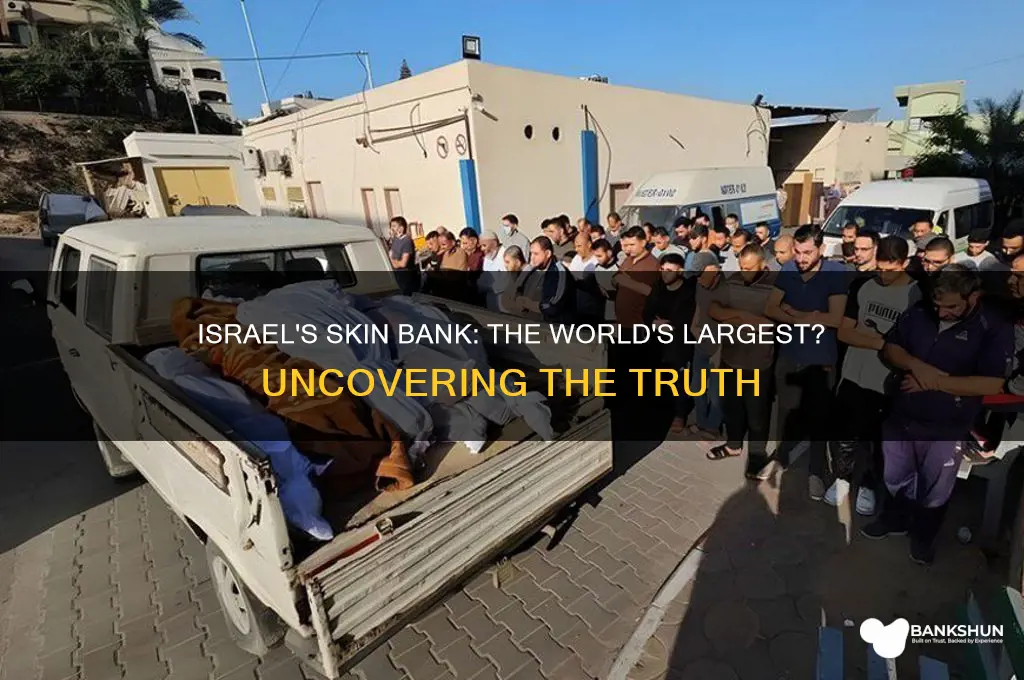 does israel have the biggest skin bank