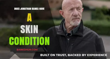 Jonathan Banks' Skin: Unraveling the Truth About His Appearance