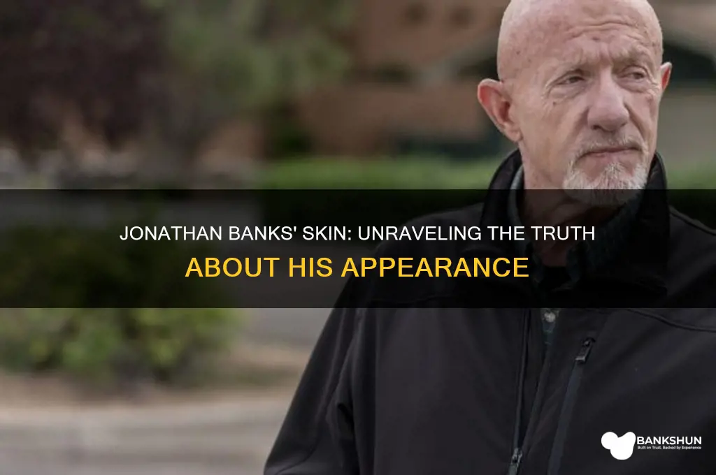 does jonathan banks have a skin condition