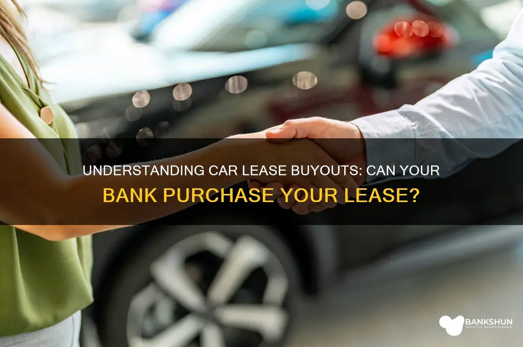 does the bank buy the car lease