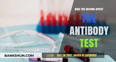 Vaccine Impact: How Does It Influence Antibody Test Results?