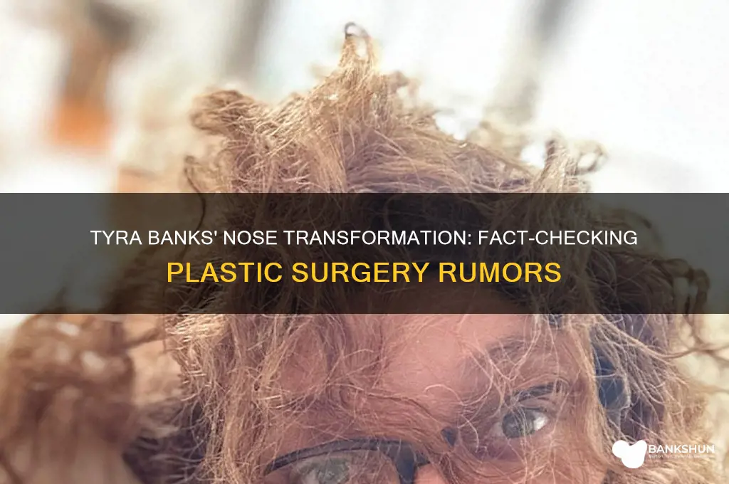 has tyra banks had a nose job