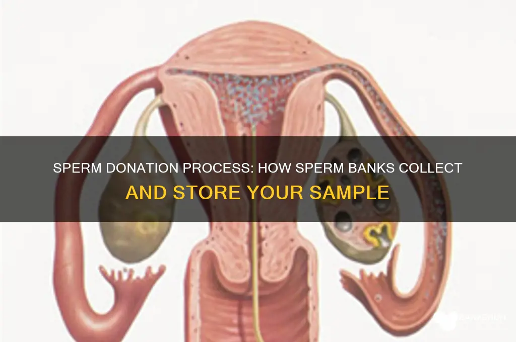 how do sperm banks collect your sperm