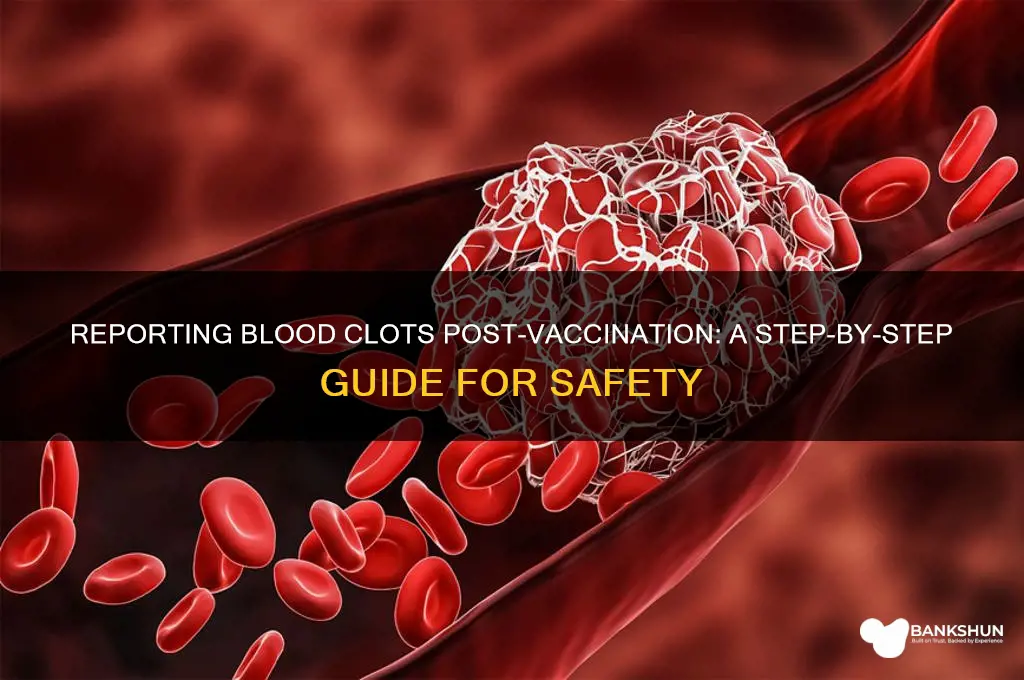 how to report blood clot after vaccine