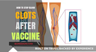 Preventing Blood Clots Post-Vaccination: Essential Tips for Safety and Health
