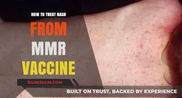 Treating MMR Vaccine Rash: Effective Remedies and Care Tips