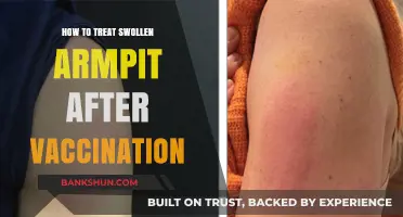 Treating Swollen Armpits Post-Vaccination: Effective Remedies and Care Tips