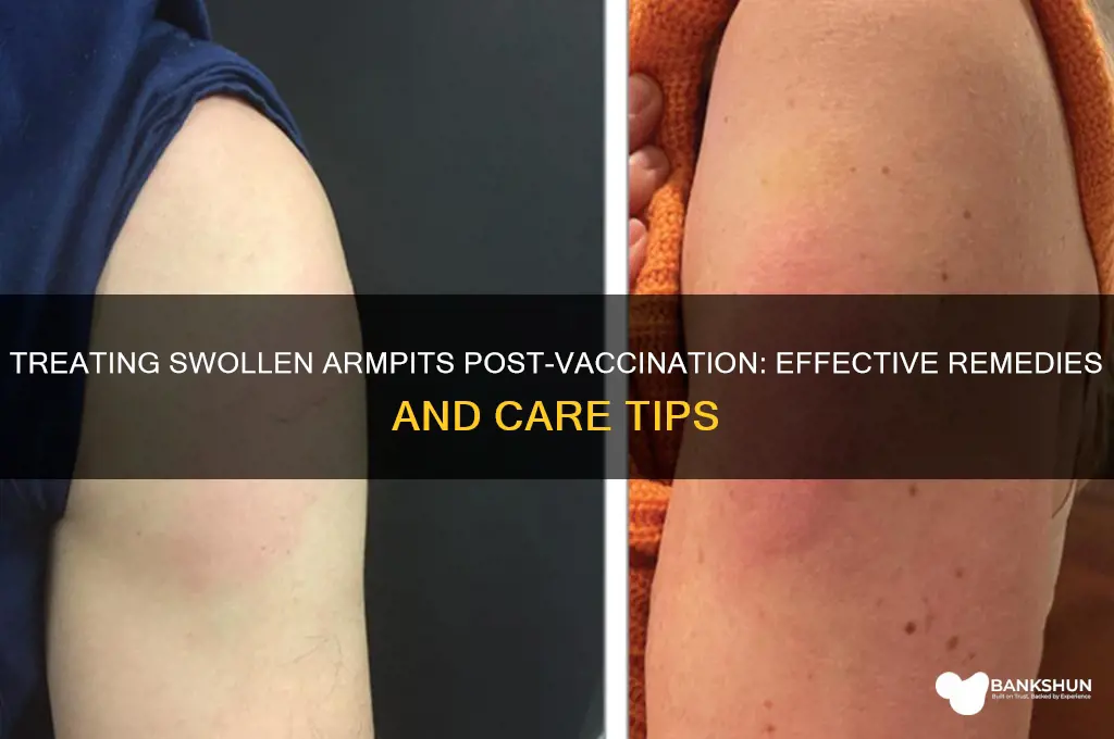 how to treat swollen armpit after vaccination