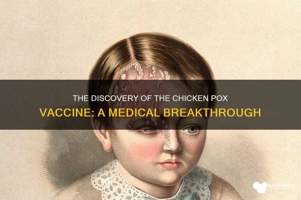 how was the chicken pox vaccine found
