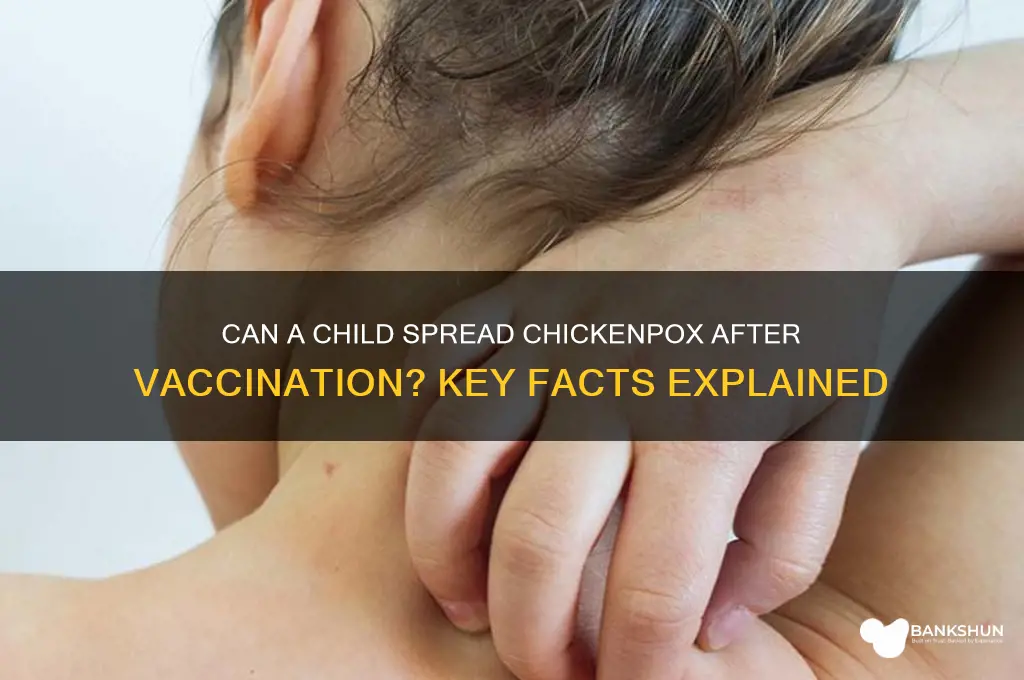 is a child contagious after chickenpox vaccine