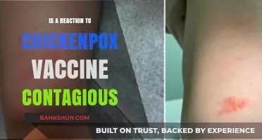 Can Chickenpox Vaccine Reactions Spread? Unraveling the Contagious Myth