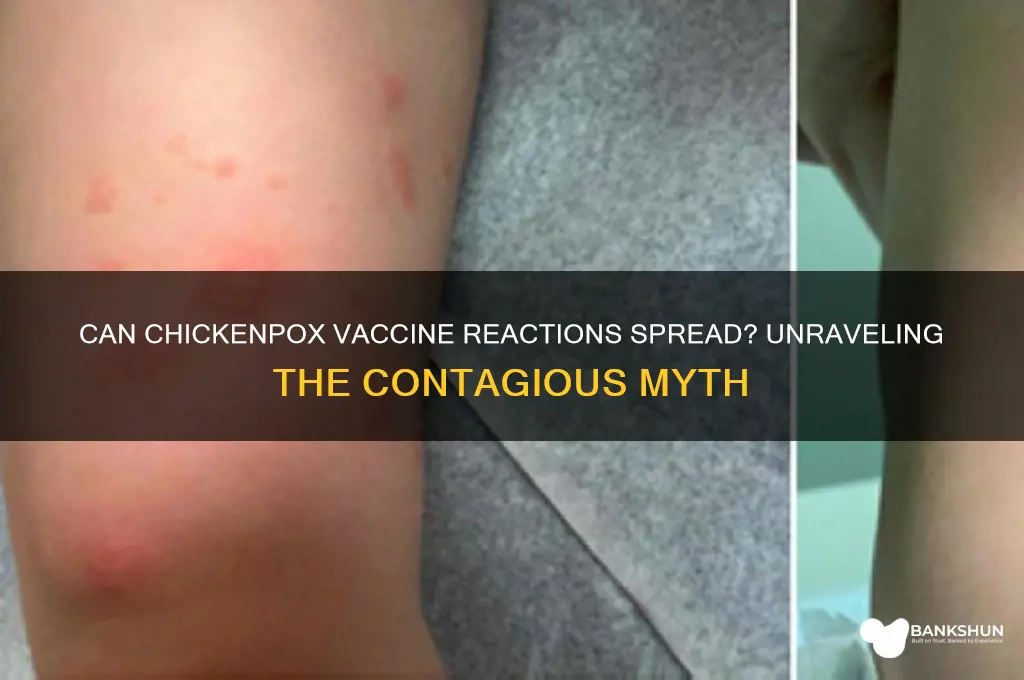 is a reaction to chickenpox vaccine contagious