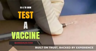 TB Skin Test vs. Vaccine: Understanding the Key Differences