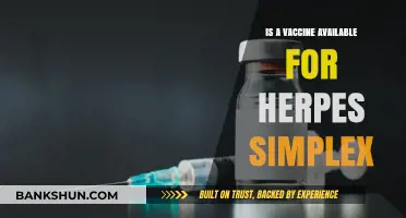 Is There a Herpes Simplex Vaccine? Current Research and Developments