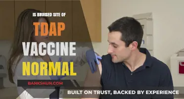 Is a Bruised Tdap Vaccine Site Normal? What to Expect