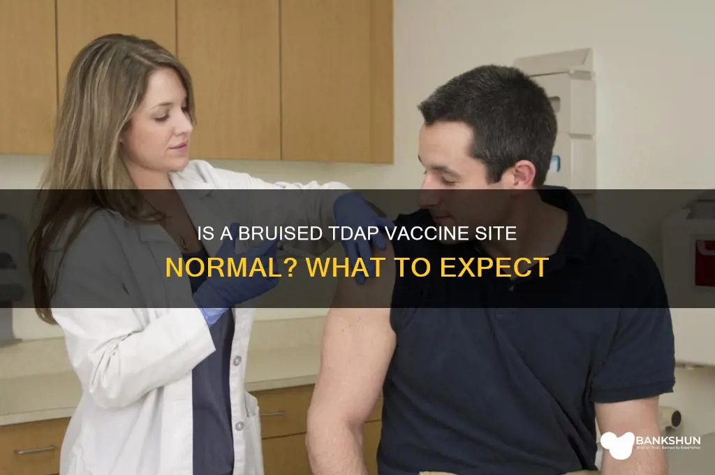 is bruised site of tdap vaccine normal