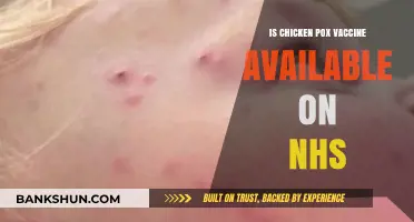 Is the Chicken Pox Vaccine Available on the NHS?