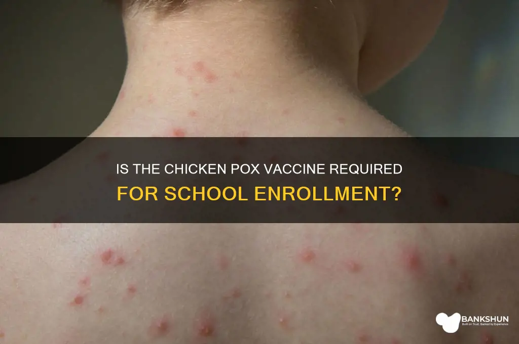 is chicken pox vaccine mandatory for school