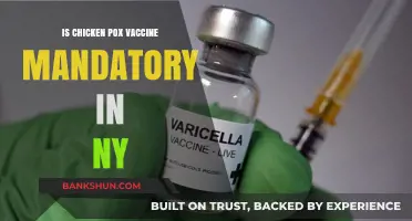 Is Chickenpox Vaccine Mandatory in NY? What Parents Need to Know