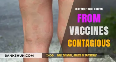 Are Vaccine-Induced Febrile Rashes Contagious? Understanding the Risks