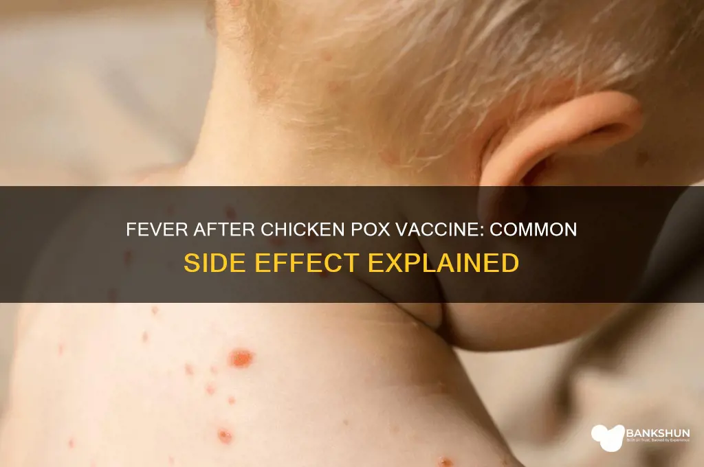 is fever common after chicken pox vaccine
