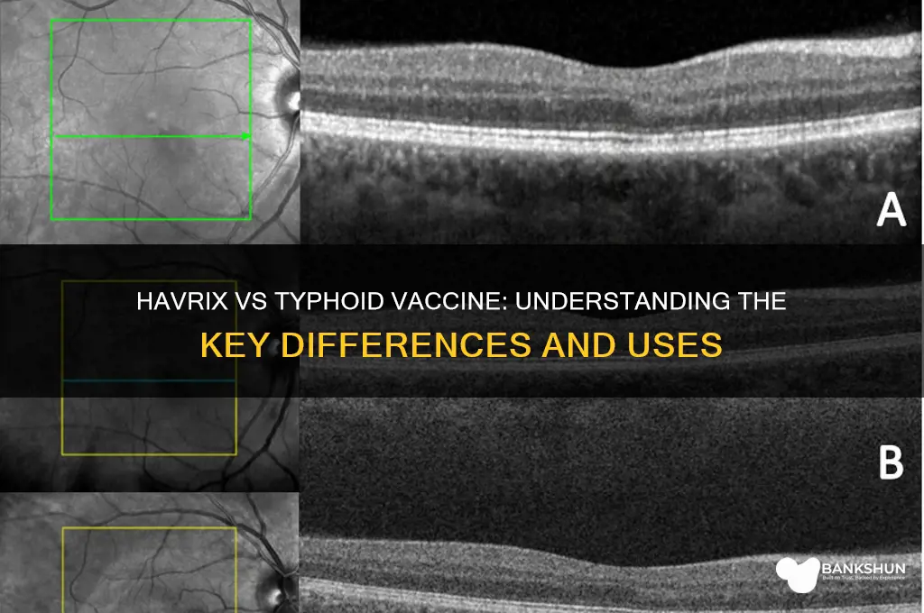 is havrix the same as typhoid vaccine
