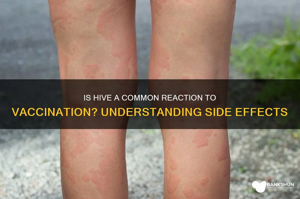 is hive a common reaction with vaccination