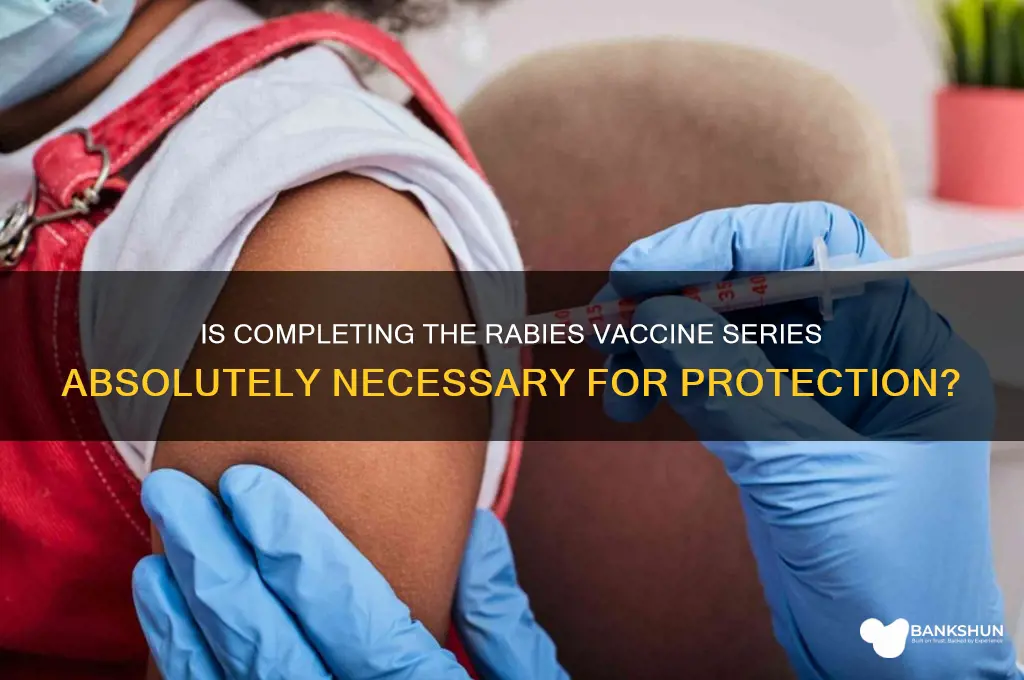 is it necessary to complete rabies vaccine
