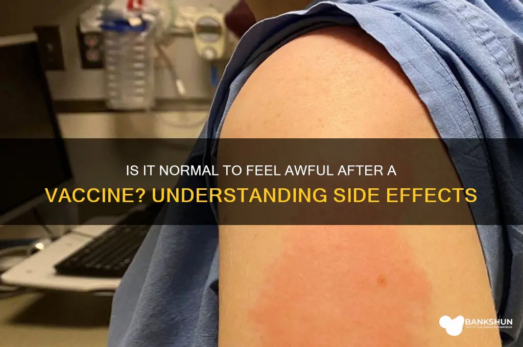 is it normal feel awful after vaccine