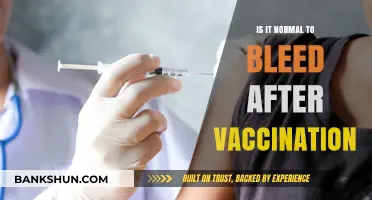 Is Post-Vaccination Bleeding Normal? Understanding Side Effects and Concerns