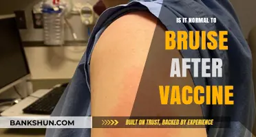 Is Bruising After a Vaccine Normal? Understanding Post-Shot Side Effects