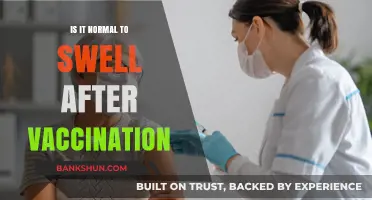Is Post-Vaccination Swelling Normal? Understanding Common Side Effects