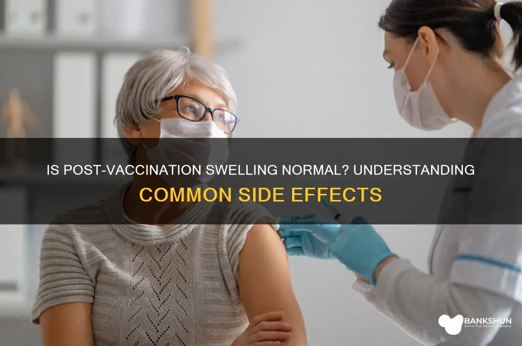 is it normal to swell after vaccination