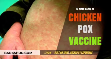 MMR vs Chickenpox Vaccine: Are They the Same or Different?