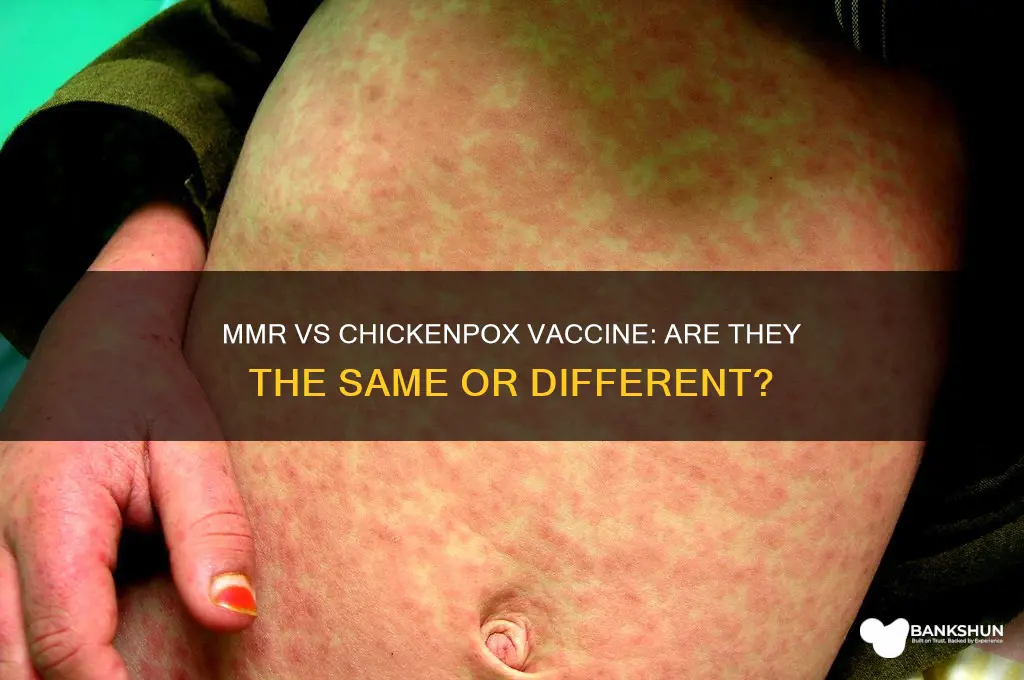is mmr same as chicken pox vaccine
