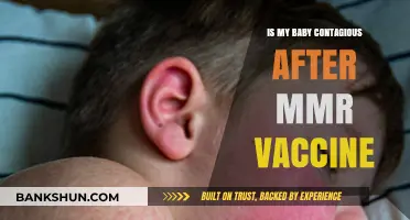 MMR Vaccine and Your Baby: Contagious Concerns Addressed