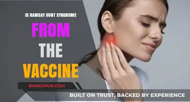 Ramsay Hunt Syndrome and Vaccine Link: Separating Fact from Fiction