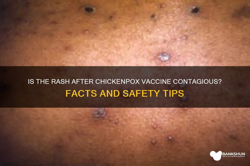 is rash after chicken pox vaccine contagious