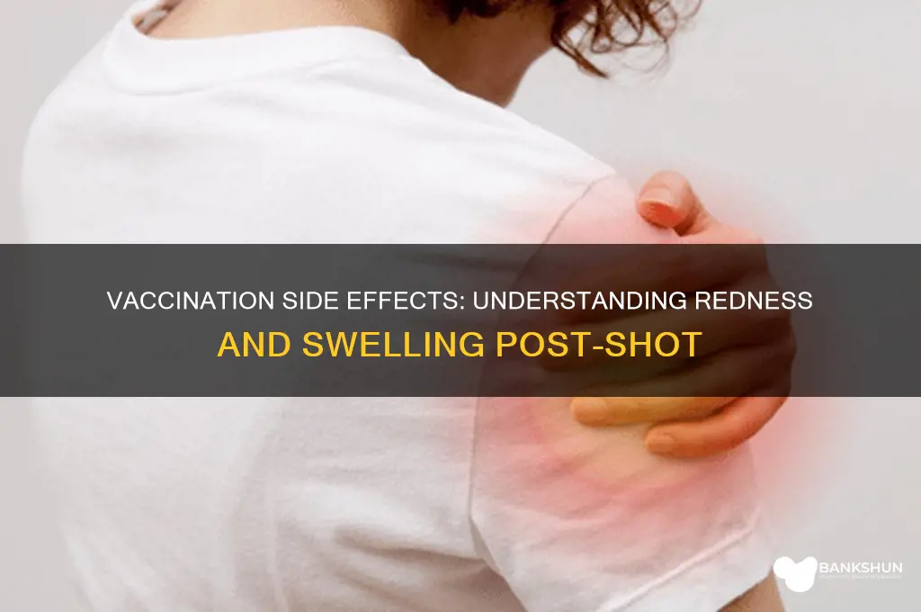 is redness and swelling normal after vaccination