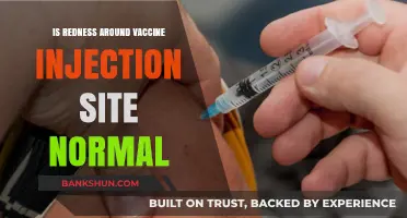Is Redness Around Vaccine Injection Site Normal? Here's What to Know