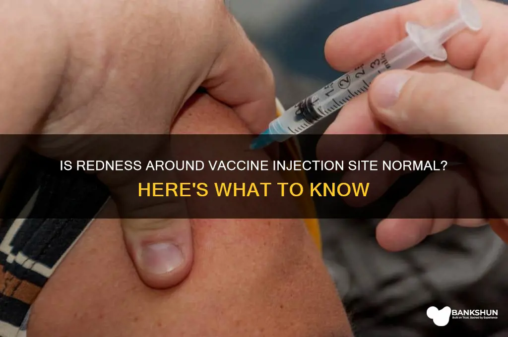 is redness around vaccine injection site normal