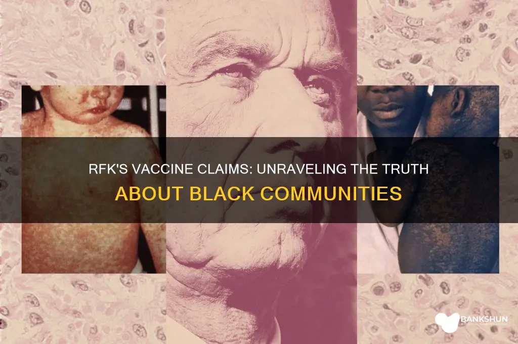is rfk right about black and vaccines