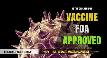 Is the Chicken Pox Vaccine FDA Approved? Facts and Insights