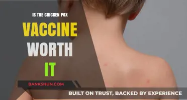 Chicken Pox Vaccine: Benefits, Risks, and Long-Term Value Explored