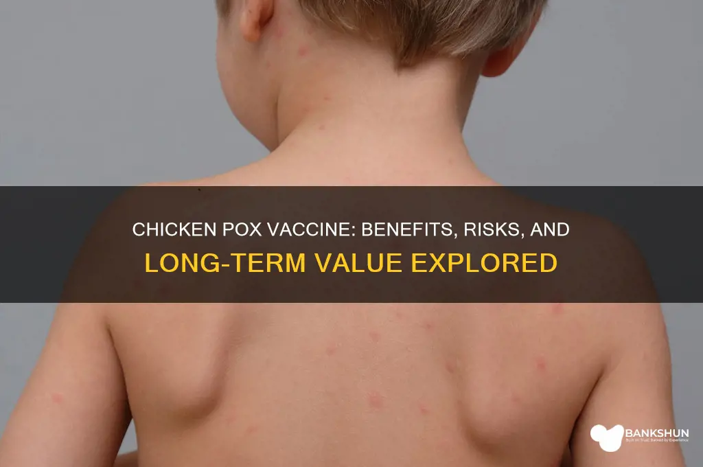 is the chicken pox vaccine worth it