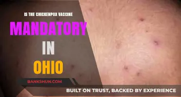 Is the Chickenpox Vaccine Mandatory in Ohio? What Parents Need to Know